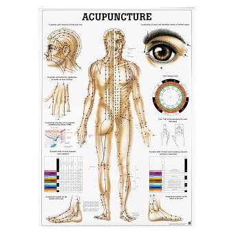 Póster de acupuntura corporal 